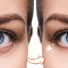 Say Goodbye To Dark Circles And Puffy Eyes!